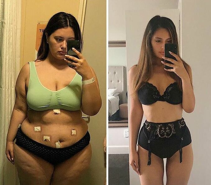 KETO Complete kapsülleri ile kilo kaybından önce ve sonra kız